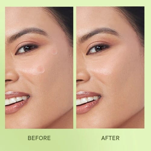 Quench – Matcha Tea Clarifying Spot Patches With Salicylic Acid And Niacinamide (12 Patches) - Image 5