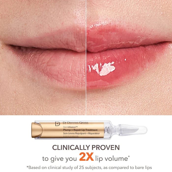 Sephora – Holiday Lip Kit (48.70ML) - Image 15